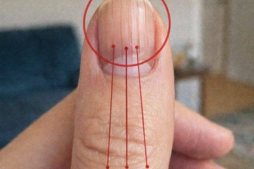 Rillen auf den Fingernägeln: Ursachen und Tipps zur Pflege